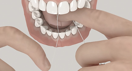 3D - Aufklärungsanimation - Zahnseide